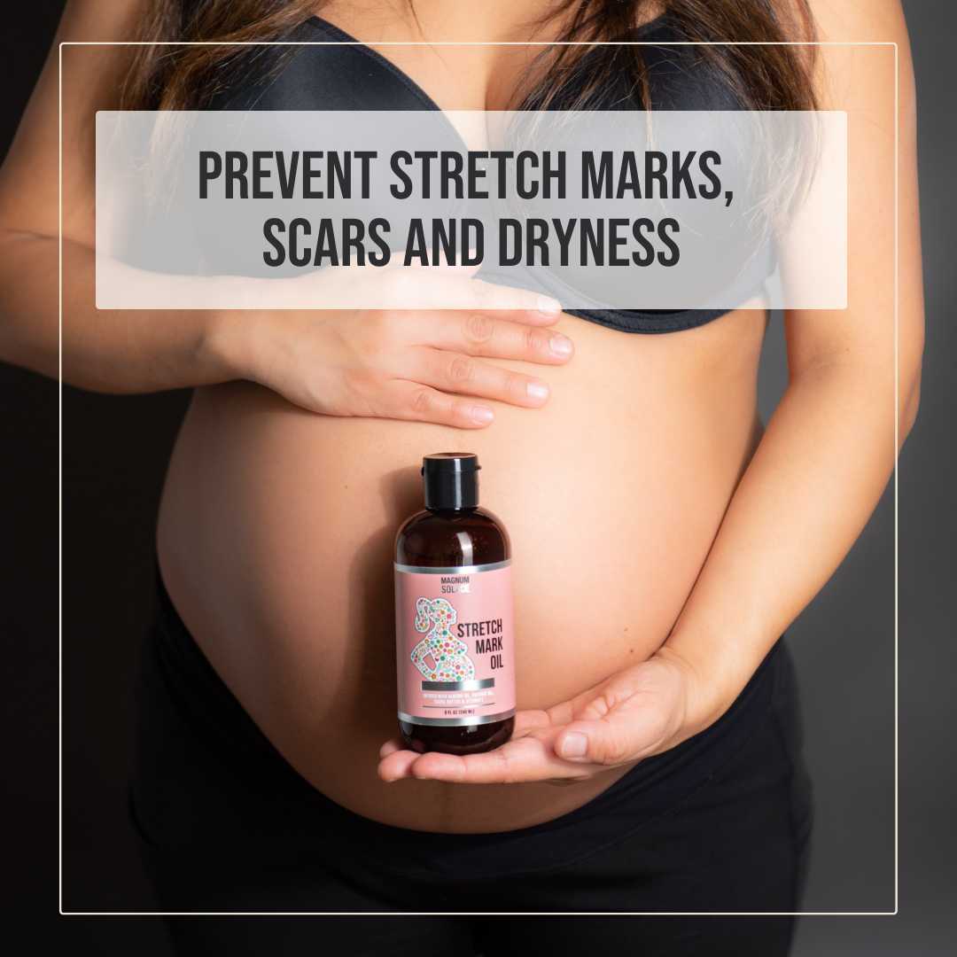 Stretch Mark Oil – 100% Natural Belly Oil for Pregnancy with Cocoa Butter